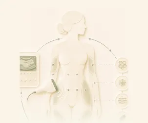 Ilustração de uma silhueta feminina com um aplicador de ultrassom e camadas da pele em destaque