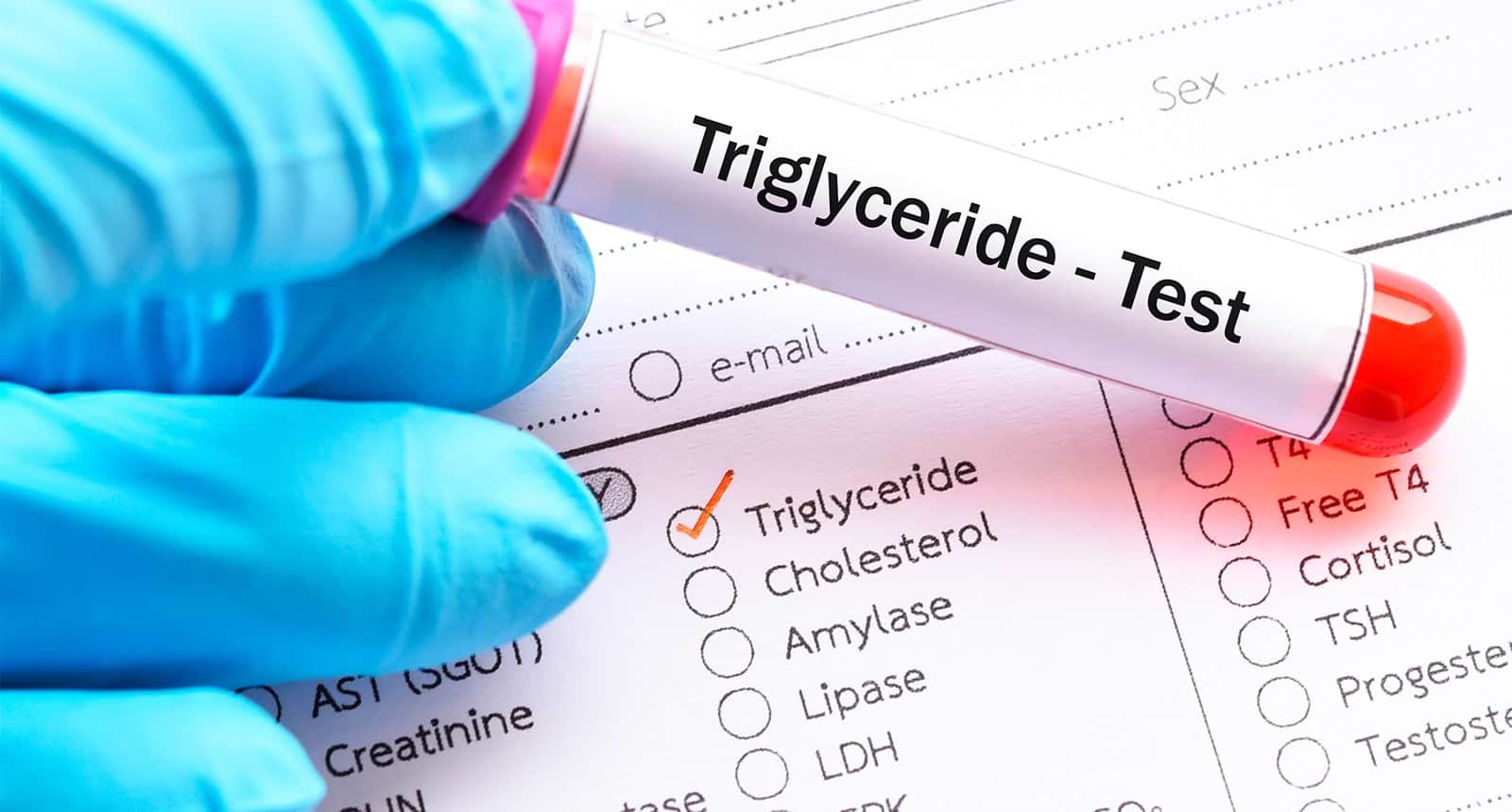 Exame de sangue para triglicerídeos - Importância do controle dos níveis de triglicerídeos com alimentação adequada